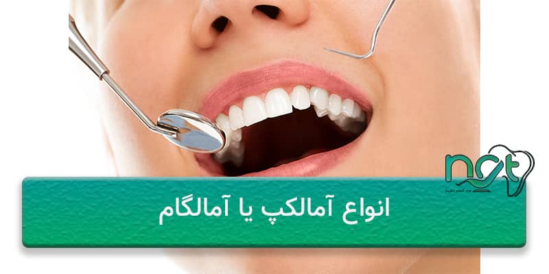 انواع آمالکپ